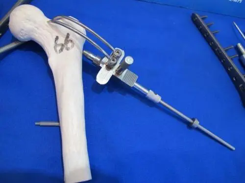 骨科国采落地在即，各方如何推动医改价值最大化？