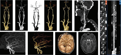 20220420_110050_140337.png 数坤3.png