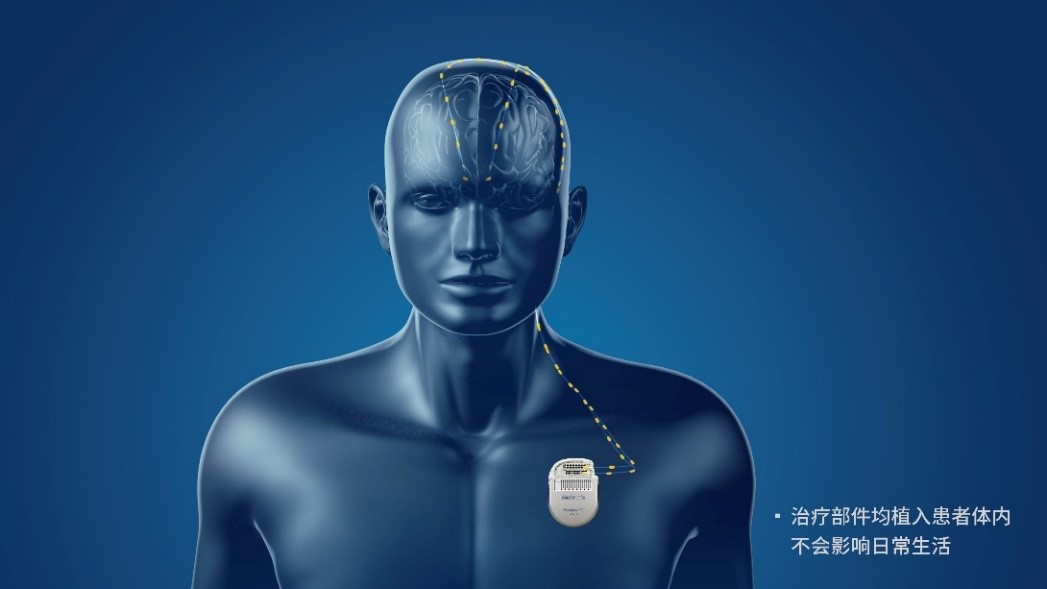 20221106_231420_239084.jpg 美敦力2.jpg