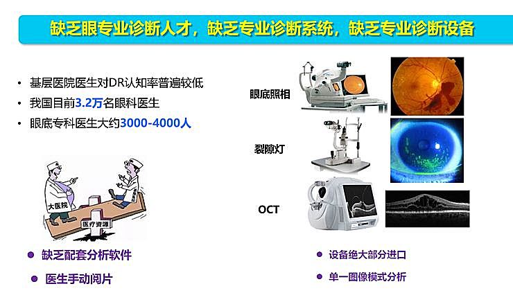 新知图谱, 全国智能眼科学组组长袁进:我们为什么要做一份修改 50 多稿的眼科 AI 筛查指南?