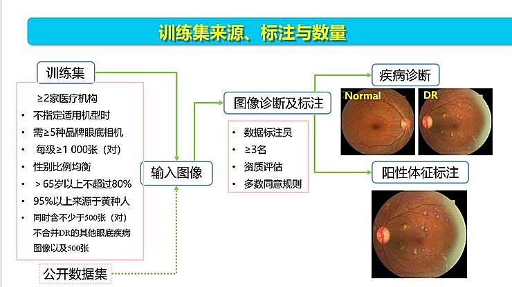 新知图谱, 全国智能眼科学组组长袁进:我们为什么要做一份修改 50 多稿的眼科 AI 筛查指南?