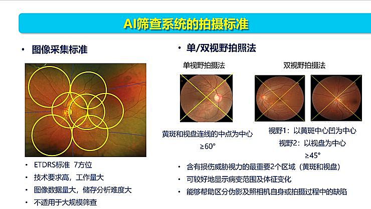 新知图谱, 全国智能眼科学组组长袁进:我们为什么要做一份修改 50 多稿的眼科 AI 筛查指南?