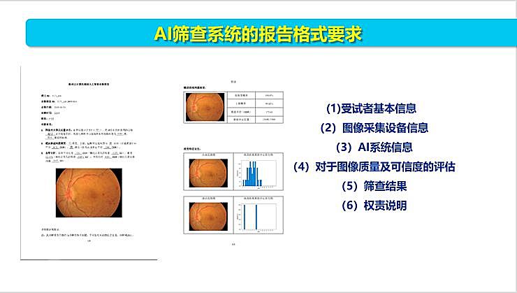 新知图谱, 全国智能眼科学组组长袁进:我们为什么要做一份修改 50 多稿的眼科 AI 筛查指南?