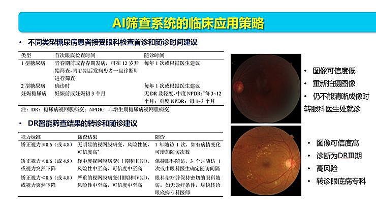 新知图谱, 全国智能眼科学组组长袁进:我们为什么要做一份修改 50 多稿的眼科 AI 筛查指南?